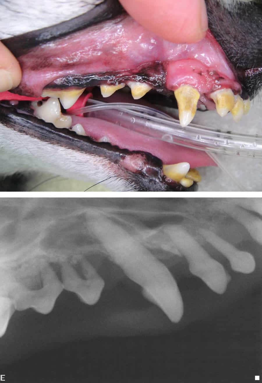 Dental Procedure