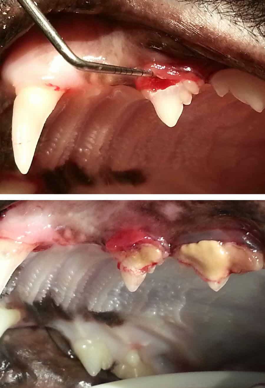 Dental Procedure
