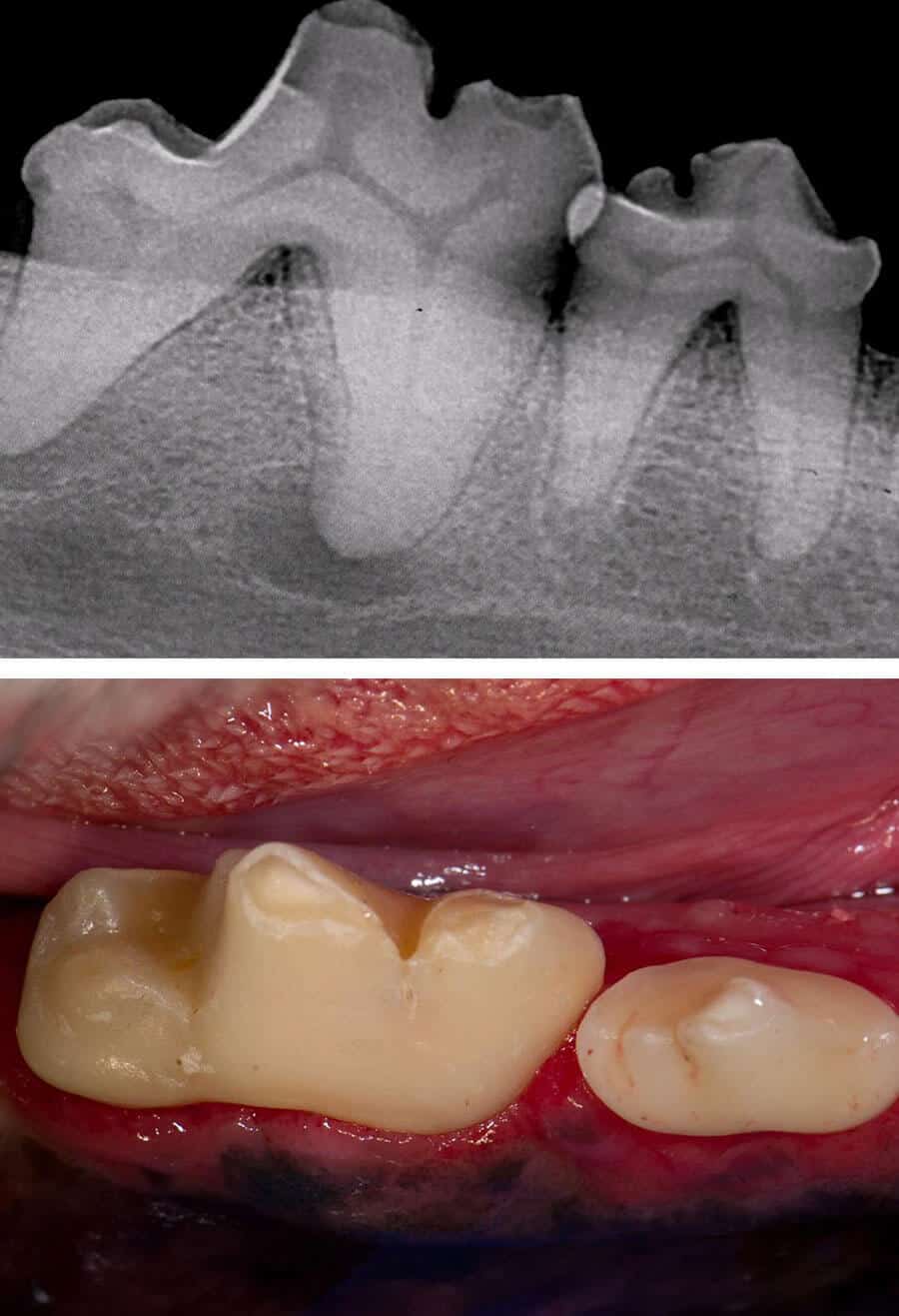 Dental Procedure