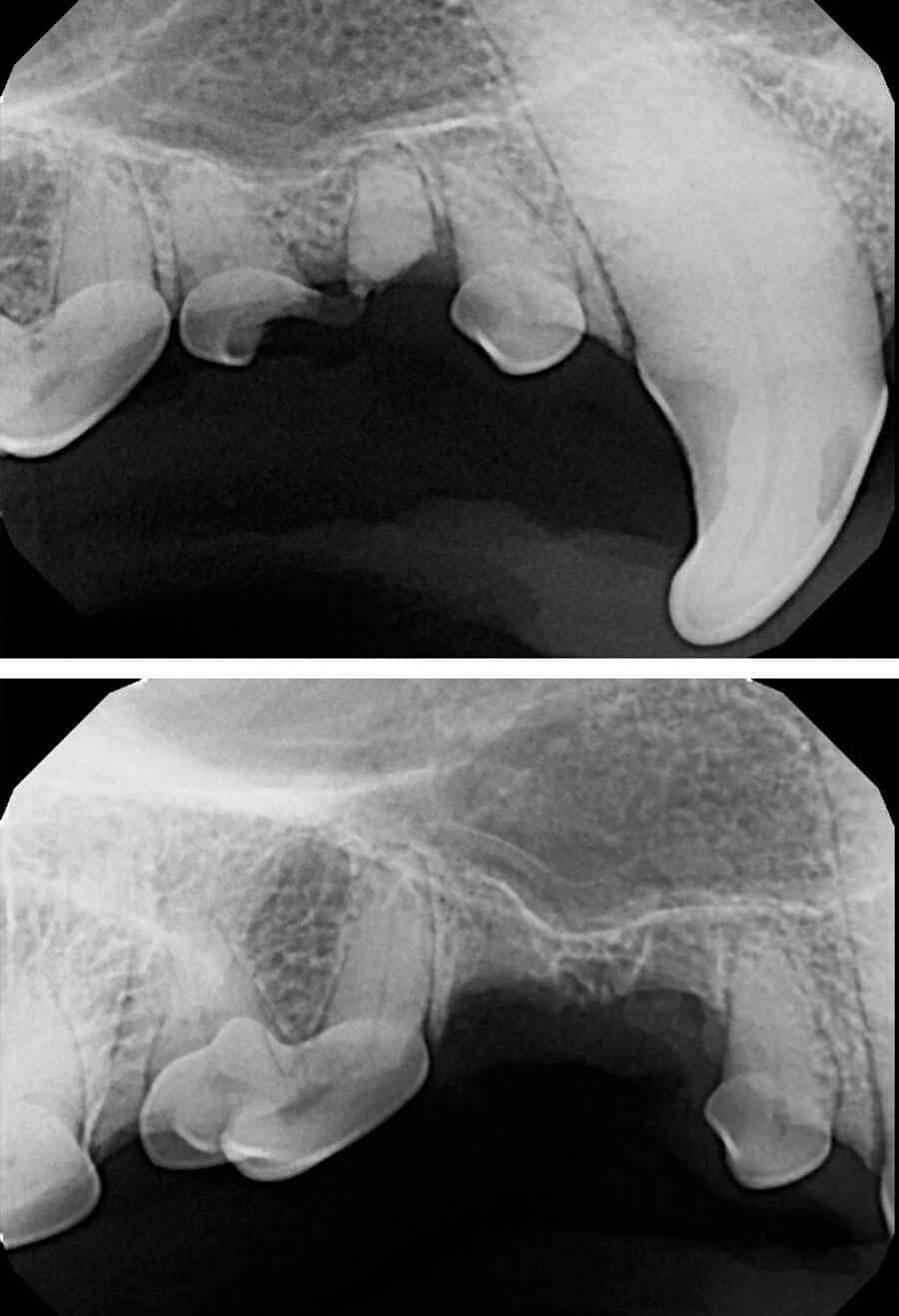 Dental Procedure